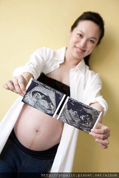 [好孕] 雙胞胎。孕期成長全記錄|超音波|產檢|必買用品|懷孕過程 @ELSA菲常好攝
