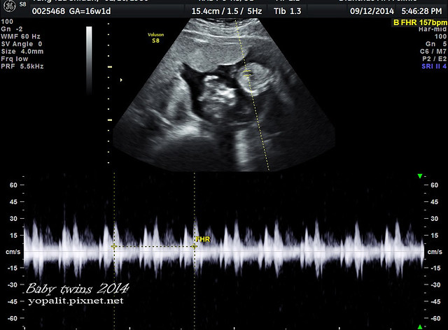 [孕] 16w超音波、雙胞胎超音波 (寶寶成長週數對照表) @ELSA菲常好攝