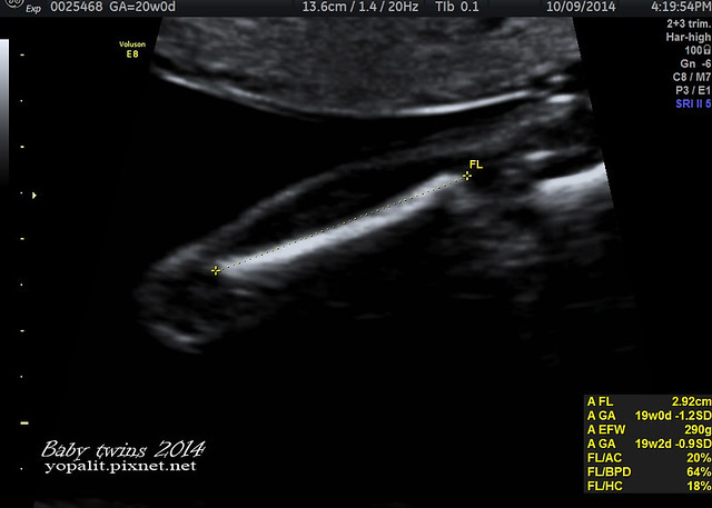 [孕] 20W 禾馨高層次超音波-雙胞胎高層次 @ELSA菲常好攝