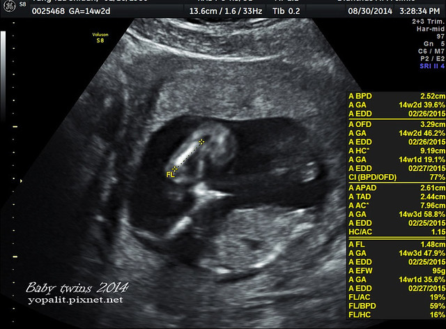 [孕] 14W超音波-雙胞胎超音波|自費產檢|禾馨婦產科收費 @ELSA菲常好攝