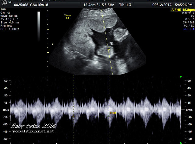[孕] 16w超音波、雙胞胎超音波 (寶寶成長週數對照表) @ELSA菲常好攝